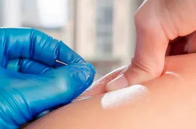 IMS/Dry Needling: An Innovative Approach for Pain Relief & Rehabi
